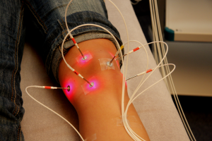 Laser Acupuncture