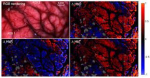 Medical Hyperspectral Imaging 