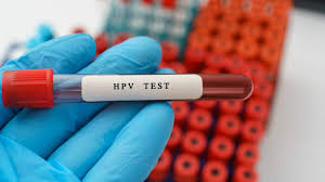 HPV Testing 