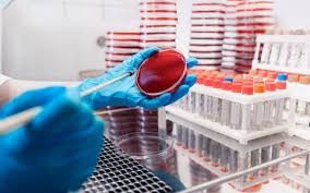 Blood Culture Test