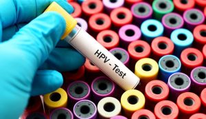 HPV Testing